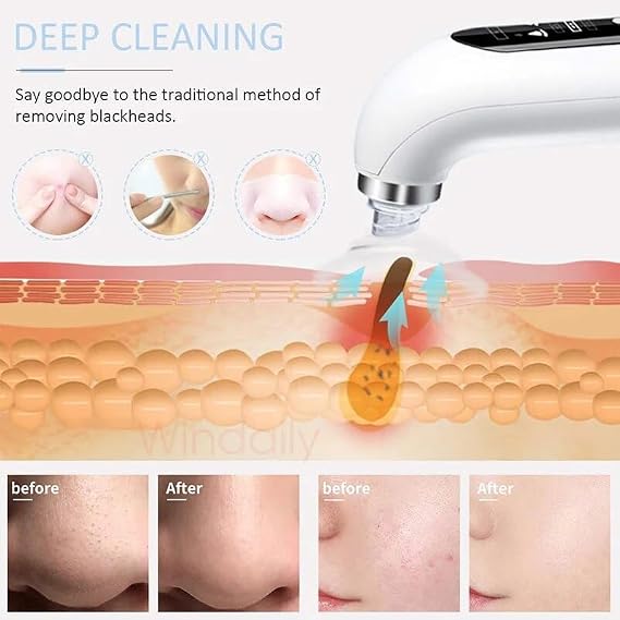 Super Micro Bubble Beauty Instrument,Hydra Facial / Water Cycling Blackhead Remover