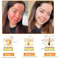 Bee Venom Cream for All Body Parts