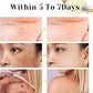 Bee Venom Cream for All Body Parts
