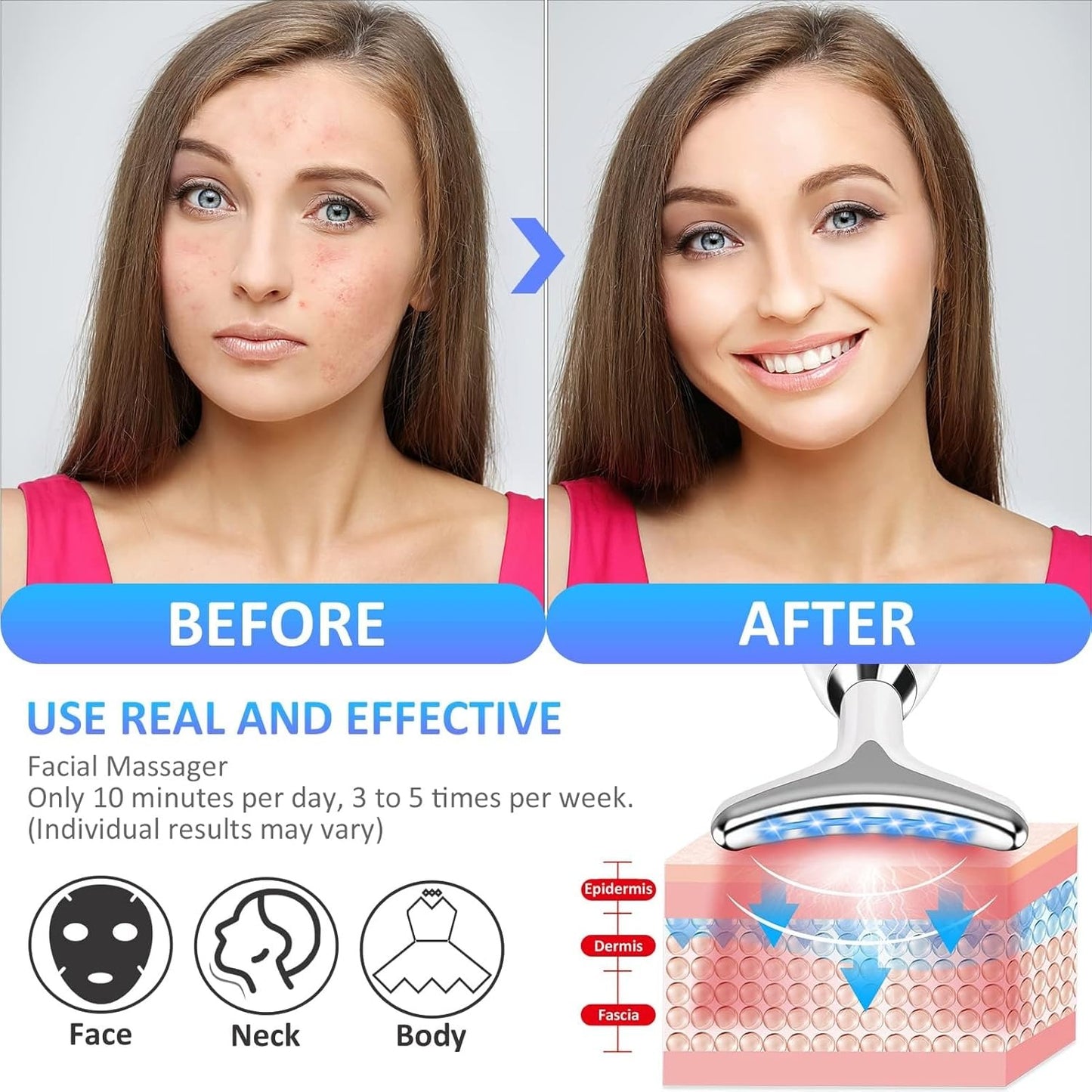 ES-1081 Massager Intense Pulsed Light Wrinkles Reducing Instrument - ESX - Anti Ageing & Reduces Puffiness | Face Massager For Fine Line & Wrinkles - Random Color